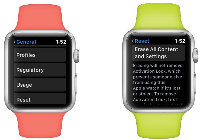  如何恢复Apple Watch的出厂设置？